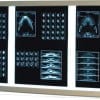 Mobiak Διαφανοσκόπιο Τριπλό (122 x 51,5 x 10,5cm) ΙΑΤΡΙΚΑ ΕΙΔΗ Mobiak Διαφανοσκόπιο Τριπλό (122 x 51,5 x 10,5cm) ΙΑΤΡΙΚΑ ΕΙΔΗ