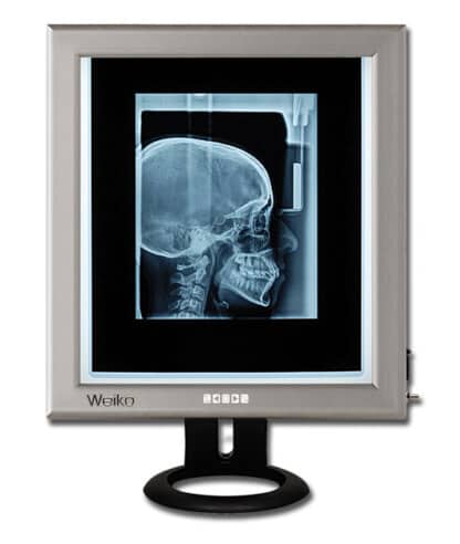 WEIKO Gima Ultra Slim Led 42x36cm Διαφανοσκόπιο με Βάση ΙΑΤΡΙΚΑ ΕΙΔΗ