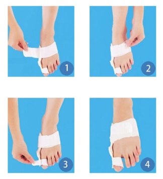 Νάρθηκας για Κότσι Hallux Valgus με Άρθρωση 10204 Μάυρο ΟΡΘΟΠΕΔΙΚΑ ΕΙΔΗ Νάρθηκας για Κότσι Hallux Valgus με Άρθρωση 10204 Μάυρο ΟΡΘΟΠΕΔΙΚΑ ΕΙΔΗ