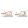 Alfa Care Κυλινδρικό Μαξιλάρι Τύπου Μc Kenzie AC-734 (45x15cm) ΟΡΘΟΠΕΔΙΚΑ ΕΙΔΗ Alfa Care Κυλινδρικό Μαξιλάρι Τύπου Μc Kenzie AC-734 (45x15cm) ΟΡΘΟΠΕΔΙΚΑ ΕΙΔΗ