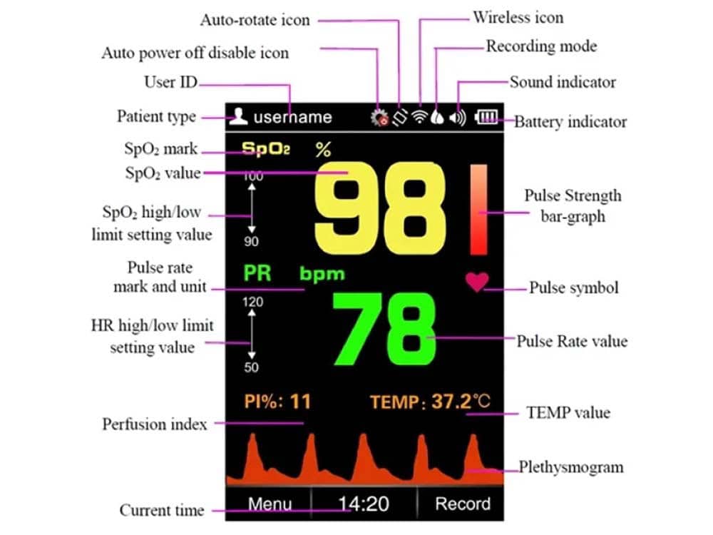Creative Medical SP-20 Παλμικό Οξύμετρο Χειρός Πορτοκαλί ΑΤΟΜΙΚΗ ΥΓΕΙΑ - ΕΥΕΞΙΑ Αξιόπιστο παλμικό οξύμετρο με πιστοποιήσεις CE & FDA